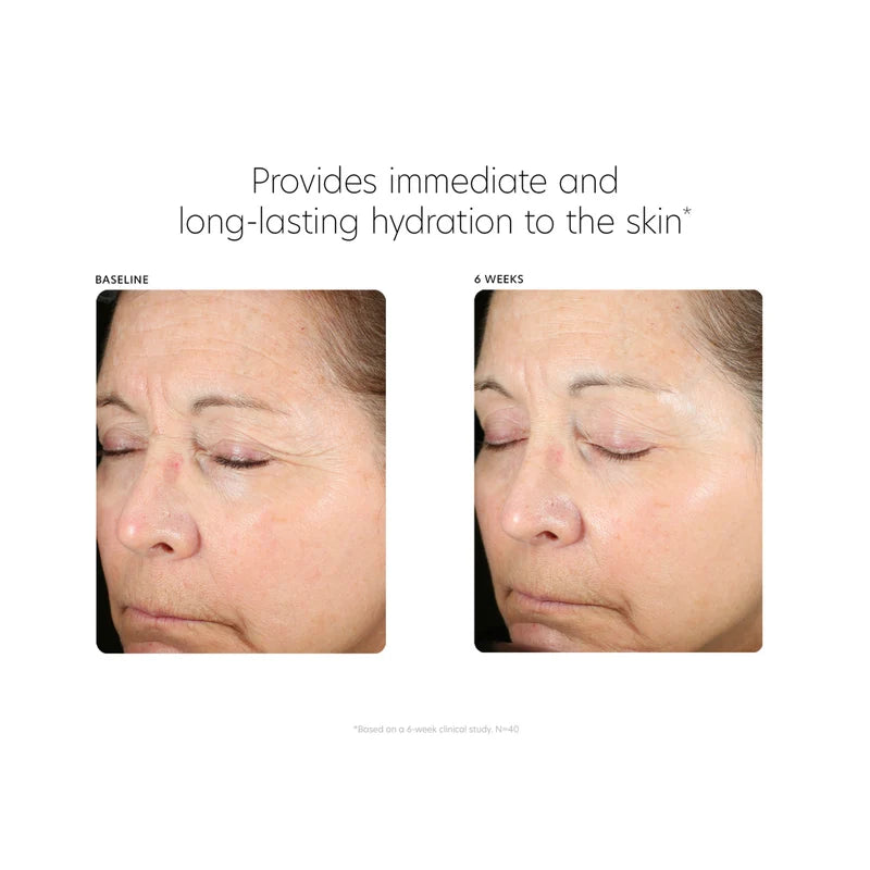 Hyaluronic Acid Boosting Serum