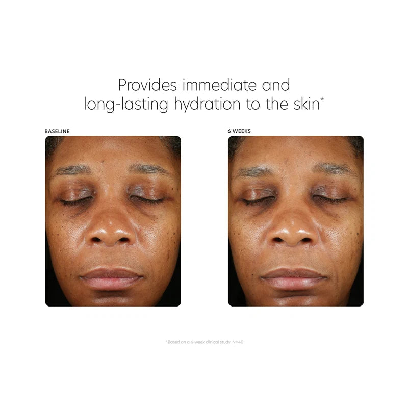 Hyaluronic Acid Boosting Serum